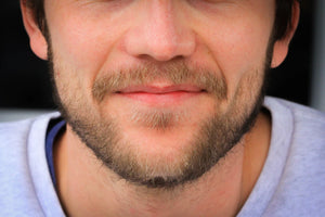 Coping with Thinning Hair Emotional and Psychological Support